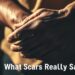 what scars really say